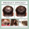 WoodSleep Original Rosemary Hair Spray, Rosemary Dense Hair Nourishing Scalp Massage Jet Black Growth Spray